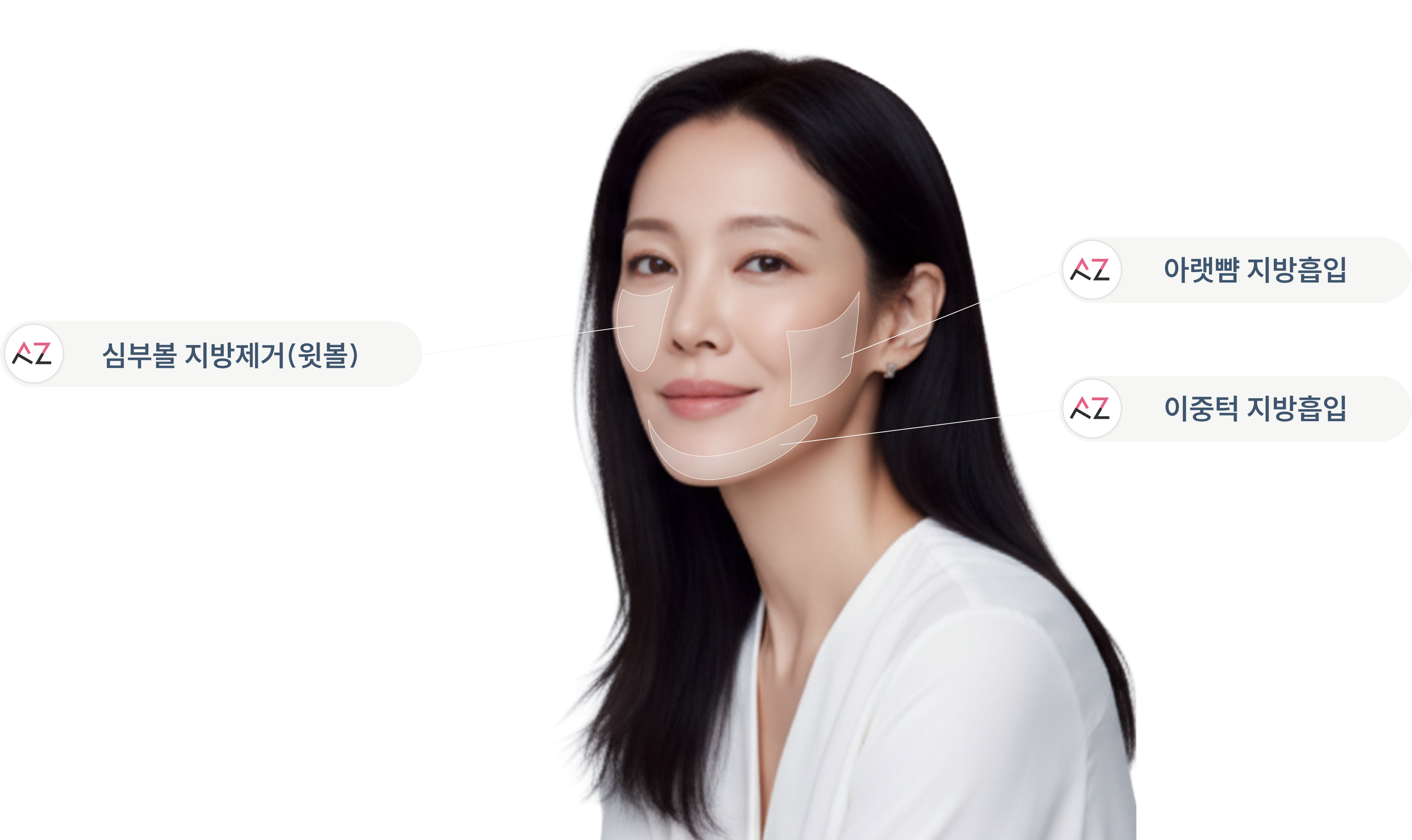 내시경 이마거상술 이미지