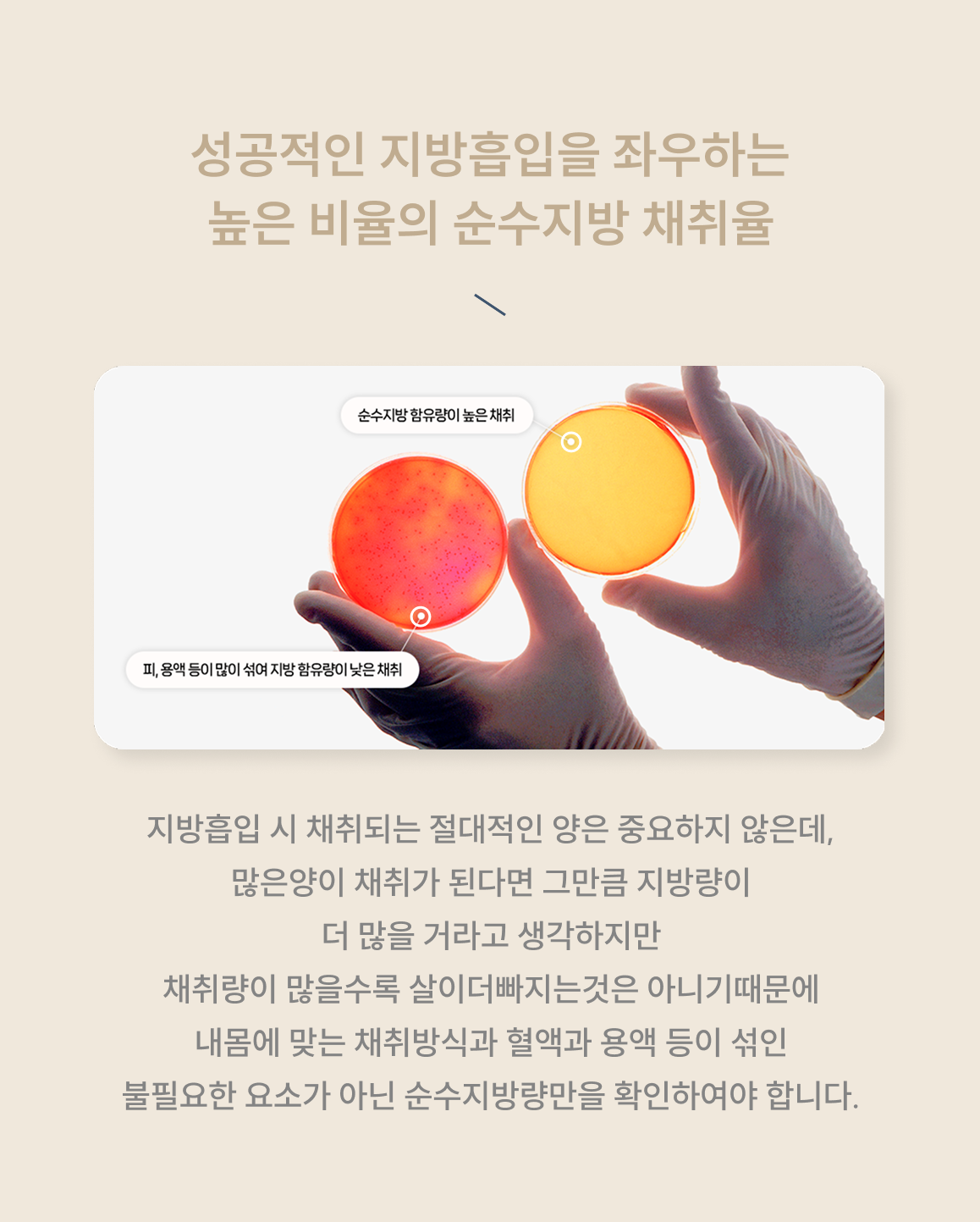 심부볼 지방제거 이미지