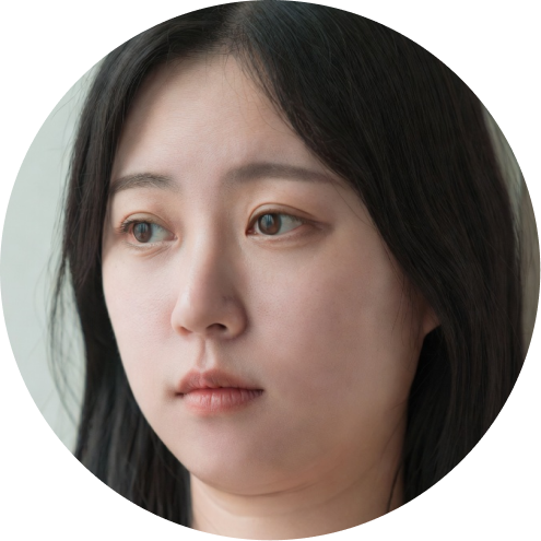 심부볼 지방제거 추천 시술 4