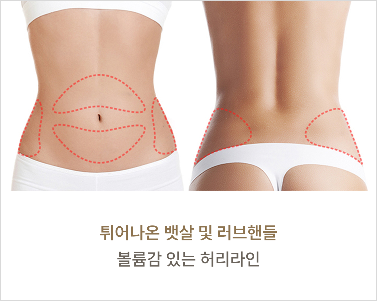 지방 분해 주사 부위별 맞춤 디자인 2