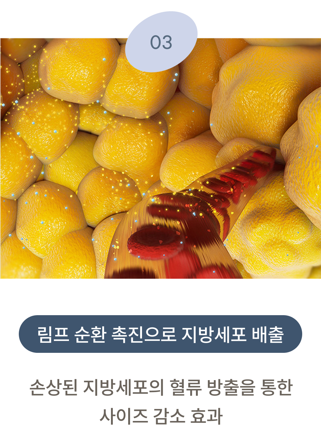 지방 분해 주사 시술원리 3